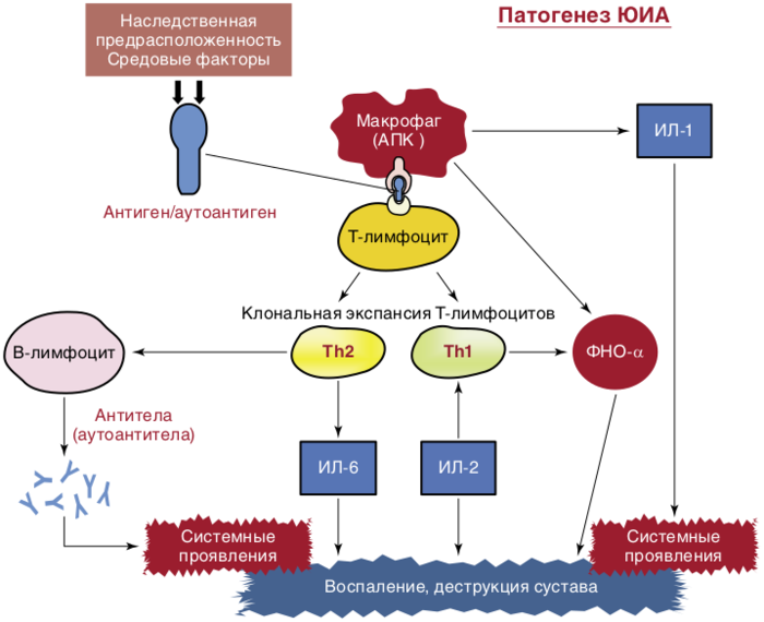 Патогенез ювенильного идиопатического артрита